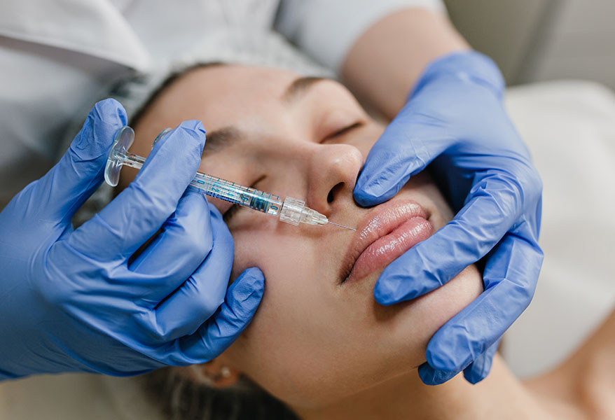 Lip Fillers